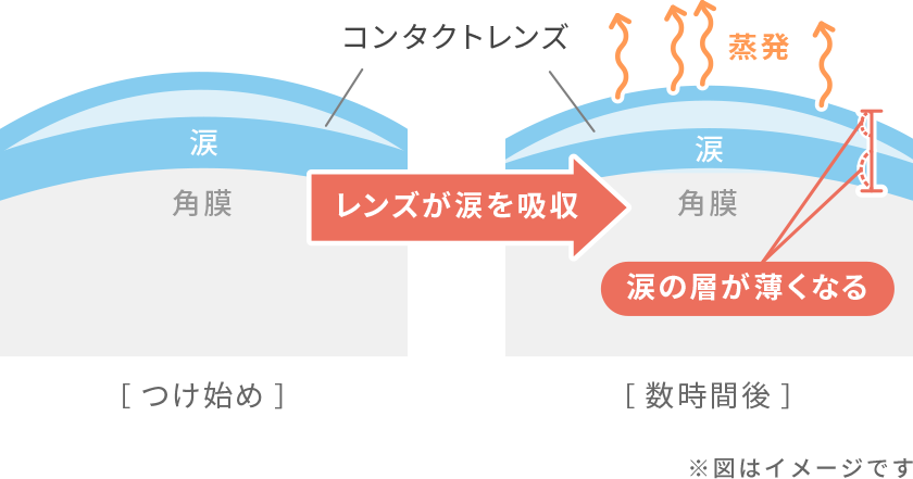 コンタクトレンズ処方まるごとマスター 楽天市場】トータル14 1箱 (6枚入り) アルコン コンタクトレンズ