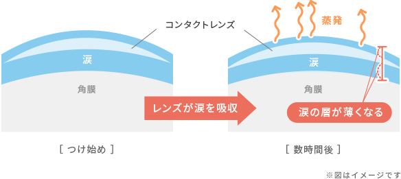 コンタクトレンズはドライアイになりやすい図式